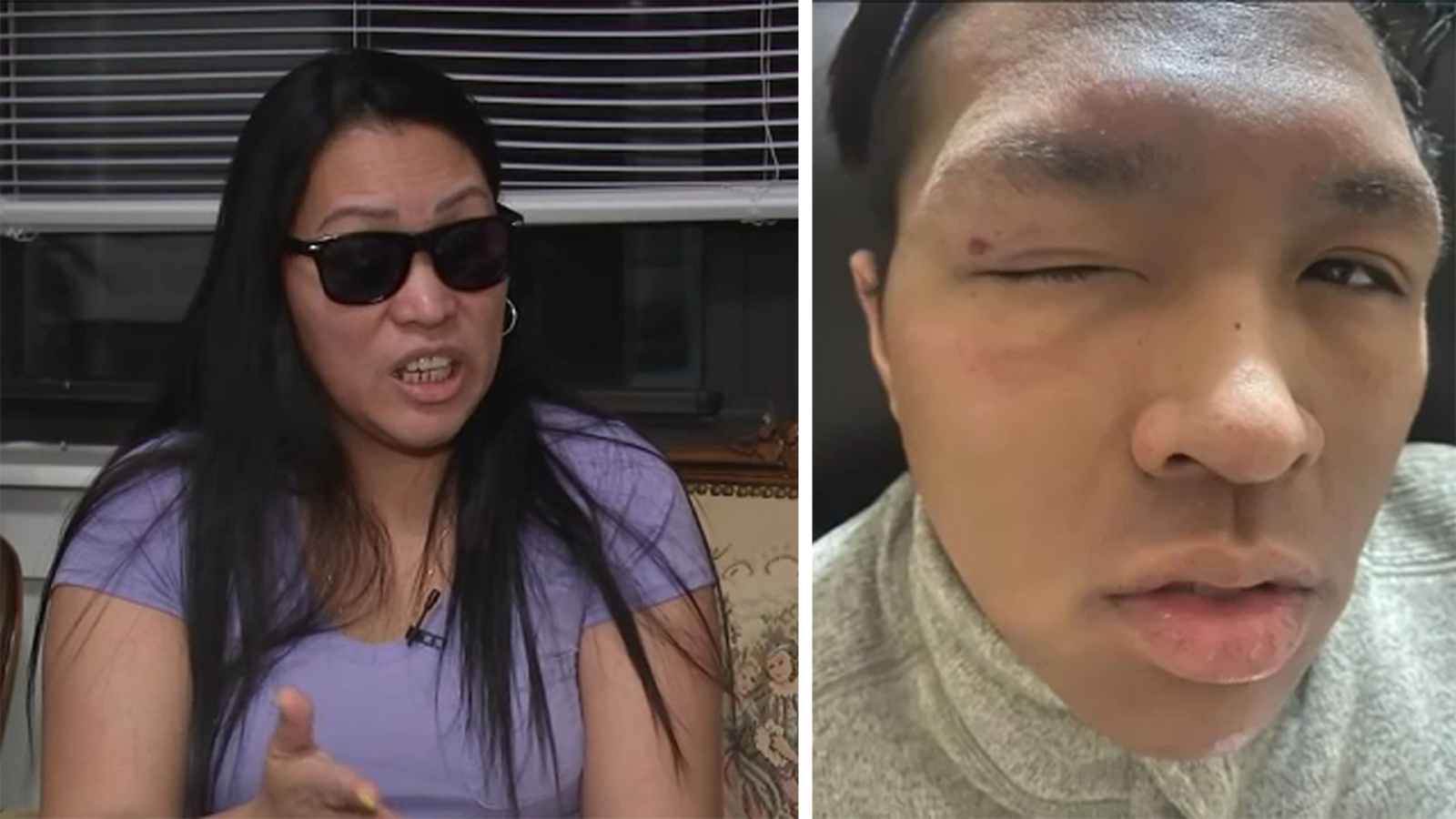 Asian woman speaks out after she and her son physically, verbally attacked in Queens